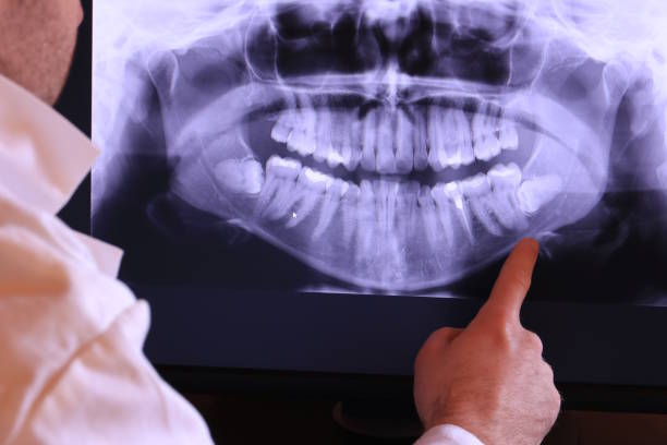 Best Emergency Treatment for Dental Infections or Abscesses in Pacific City, OR